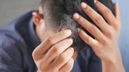 Ar plikimas reiškia gyvenimo pabaigą? Tiesa apie plaukų slinkimą